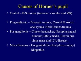 Causes of Horner’s pupil
• Central – B/S lesions (tumours, vascular and MS)
• Preganglionic – Pancoast tumour, Carotid & Aortic
aneurysms, Neck lesions/trauma.
Postganglionic – Cluster headaches, Nasopharyngeal
tumours, Otitis media, Cavernous
sinus mass and ICA disease.
Miscellaneous – Congenital (brachial plexus injury)
Idiopathic.
•
•
 