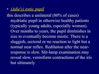• )Adie's) tonic pupil
this describes a unilateral (80% of cases)
mydriatic pupil in otherwise healthy patients
(typically young adults, especially women).
Over months to years, the pupil diminishes in
size to eventually become miotic. There is a
sluggish, sectoral or no reaction to light but a
normal near reflex. Redilation after the near-
response is slow. Slit-lamp examination may
reveal slow, vermiform contractions of the iris
but ultimately
 