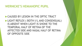 WERNICKE’S HEMIANOPIC PUPIL
 CAUSED BY LESION IN THE OPTIC TRACT
 LIGHT REFLEX ( BOTH I/L AND CONSENSUAL)
IS ABSENT WHEN LIGHT IS SHONE TO THE
TEMPORAL HALF OF RETINA OF THE
AFFECTED SIDE AND NASAL HALF OF RETINA
OF OPPOSITE SIDE
 