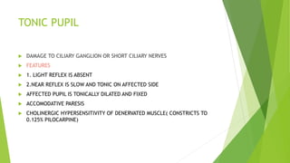 TONIC PUPIL
 DAMAGE TO CILIARY GANGLION OR SHORT CILIARY NERVES
 FEATURES
 1. LIGHT REFLEX IS ABSENT
 2.NEAR REFLEX IS SLOW AND TONIC ON AFFECTED SIDE
 AFFECTED PUPIL IS TONICALLY DILATED AND FIXED
 ACCOMODATIVE PARESIS
 CHOLINERGIC HYPERSENSITIVITY OF DENERVATED MUSCLE( CONSTRICTS TO
0.125% PILOCARPINE)
 