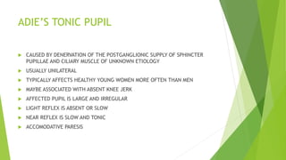 ADIE’S TONIC PUPIL
 CAUSED BY DENERVATION OF THE POSTGANGLIONIC SUPPLY OF SPHINCTER
PUPILLAE AND CILIARY MUSCLE OF UNKNOWN ETIOLOGY
 USUALLY UNILATERAL
 TYPICALLY AFFECTS HEALTHY YOUNG WOMEN MORE OFTEN THAN MEN
 MAYBE ASSOCIATED WITH ABSENT KNEE JERK
 AFFECTED PUPIL IS LARGE AND IRREGULAR
 LIGHT REFLEX IS ABSENT OR SLOW
 NEAR REFLEX IS SLOW AND TONIC
 ACCOMODATIVE PARESIS
 
