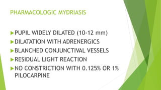 PHARMACOLOGIC MYDRIASIS
PUPIL WIDELY DILATED (10-12 mm)
DILATATION WITH ADRENERGICS
BLANCHED CONJUNCTIVAL VESSELS
RESIDUAL LIGHT REACTION
NO CONSTRICTION WITH 0.125% OR 1%
PILOCARPINE
 