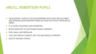 ARGYLL ROBERTSON PUPILS
 LOCALIZATION- LESION IN TECTUM INTERFERES WITH LIGHT REFLEX FIBRES
AND SUPRANUCLEAR INHIBITORY FIBRES BUT DOES NOT AFFECT NEAR REFLEX
FIBRES.
 IT IS USUALLY BILATERAL AND ASYMMETRIC.
 RETINA SENSITIVE TO LIGHT(GOOD VISION IS PRESENT)
 PUPIL SMALL AND IRREGULAR.
 THE LIGHT REFLEX IS ABSENT, BUT THE NEAR REFLEX IS PRESENT
 SEEN IN TERTIARY SYPHILIS
 