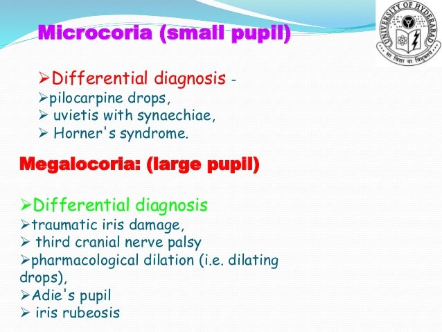 fixed dilated pupil differential diagnosis fixed dilated pupil differential diagnosis