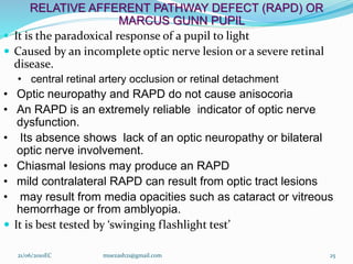 RELATIVE AFFERENT PATHWAY DEFECT (RAPD) OR
MARCUS GUNN PUPIL
 It is the paradoxical response of a pupil to light
 Caused by an incomplete optic nerve lesion or a severe retinal
disease.
• central retinal artery occlusion or retinal detachment
• Optic neuropathy and RAPD do not cause anisocoria
• An RAPD is an extremely reliable indicator of optic nerve
dysfunction.
• Its absence shows lack of an optic neuropathy or bilateral
optic nerve involvement.
• Chiasmal lesions may produce an RAPD
• mild contralateral RAPD can result from optic tract lesions
• may result from media opacities such as cataract or vitreous
hemorrhage or from amblyopia.
 It is best tested by ‘swinging flashlight test’
25
21/06/2010EC muezash21@gmail.com
 