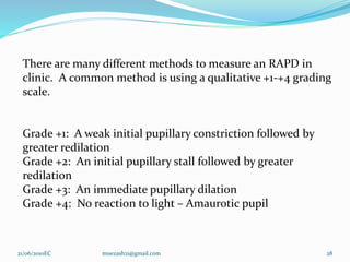28
There are many different methods to measure an RAPD in
clinic. A common method is using a qualitative +1-+4 grading
scale.
Grade +1: A weak initial pupillary constriction followed by
greater redilation
Grade +2: An initial pupillary stall followed by greater
redilation
Grade +3: An immediate pupillary dilation
Grade +4: No reaction to light – Amaurotic pupil
21/06/2010EC muezash21@gmail.com
 