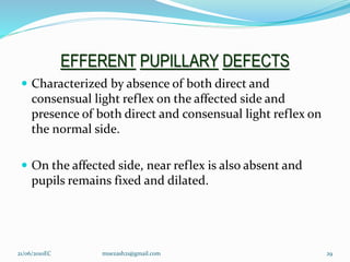 EFFERENT PUPILLARY DEFECTS
 Characterized by absence of both direct and
consensual light reflex on the affected side and
presence of both direct and consensual light reflex on
the normal side.
 On the affected side, near reflex is also absent and
pupils remains fixed and dilated.
29
21/06/2010EC muezash21@gmail.com
 