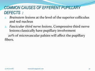 COMMON CAUSES OF EFFERENT PUPILLARY
DEFECTS :
1. Brainstem lesions at the level of the superior colliculus
and red nucleus
2. Fascicular third nerve lesions. Compressive third nerve
lesions classically have pupillary involvement
20% of microvascular palsies will affect the pupillary
fibers.
30
21/06/2010EC muezash21@gmail.com
 