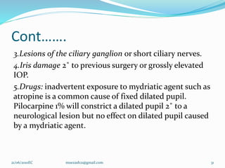 Cont…….
3.Lesions of the ciliary ganglion or short ciliary nerves.
4.Iris damage 2˚ to previous surgery or grossly elevated
IOP.
5.Drugs: inadvertent exposure to mydriatic agent such as
atropine is a common cause of fixed dilated pupil.
Pilocarpine 1% will constrict a dilated pupil 2˚ to a
neurological lesion but no effect on dilated pupil caused
by a mydriatic agent.
31
21/06/2010EC muezash21@gmail.com
 