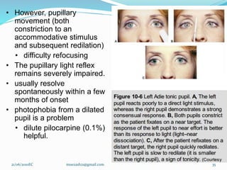 • However, pupillary
movement (both
constriction to an
accommodative stimulus
and subsequent redilation)
• difficulty refocusing
• The pupillary light reflex
remains severely impaired.
• usually resolve
spontaneously within a few
months of onset
• photophobia from a dilated
pupil is a problem
• dilute pilocarpine (0.1%)
helpful.
21/06/2010EC muezash21@gmail.com 35
 