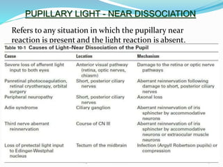 PUPILLARY LIGHT - NEAR DISSOCIATION
Refers to any situation in which the pupillary near
reaction is present and the light reaction is absent.
38
21/06/2010EC muezash21@gmail.com
 