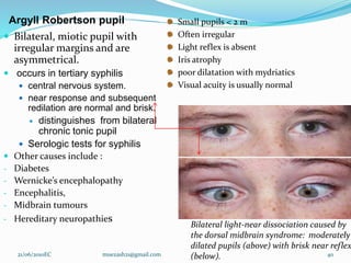 Argyll Robertson pupil
 Bilateral, miotic pupil with
irregular margins and are
asymmetrical.
 occurs in tertiary syphilis
 central nervous system.
 near response and subsequent
redilation are normal and brisk.
 distinguishes from bilateral
chronic tonic pupil
 Serologic tests for syphilis
 Other causes include :
- Diabetes
- Wernicke’s encephalopathy
- Encephalitis,
- Midbrain tumours
- Hereditary neuropathies
21/06/2010EC muezash21@gmail.com 40
Bilateral light-near dissociation caused by
the dorsal midbrain syndrome: moderately
dilated pupils (above) with brisk near reflex
(below).
Small pupils < 2 m
Often irregular
Light reflex is absent
Iris atrophy
poor dilatation with mydriatics
Visual acuity is usually normal
 