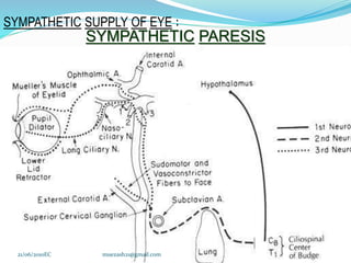 SYMPATHETIC PARESIS
SYMPATHETIC SUPPLY OF EYE :
43
21/06/2010EC muezash21@gmail.com
 