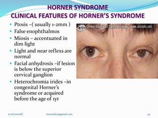 HORNER SYNDROME
CLINICAL FEATURES OF HORNER’S SYNDROME
 Ptosis –( usually 1-2mm )
 False enophthalmos
 Miosis – accentuated in
dim light
 Light and near reflexs are
normal
 Facial anhydrosis –if lesion
is below the superior
cervical ganglion
 Heterochromia irides –in
congenital Horner’s
syndrome or acquired
before the age of 1yr
21/06/2010EC muezash21@gmail.com 44
 