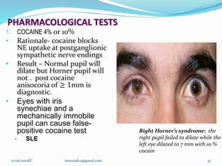 PHARMACOLOGICAL TESTS
1. COCAINE 4% or 10%
• Rationale- cocaine blocks
NE uptake at postganglionic
sympathetic nerve endings
• Result – Normal pupil will
dilate but Horner pupil will
not . post cocaine
anisocoria of ≥ 1mm is
diagnostic.
• Eyes with iris
synechiae and a
mechanically immobile
pupil can cause false-
positive cocaine test
• SLE
21/06/2010EC muezash21@gmail.com 47
Right Horner’s syndrome: the
right pupil failed to dilate while the
left eye dilated to 7 mm with 10 %
cocain
 