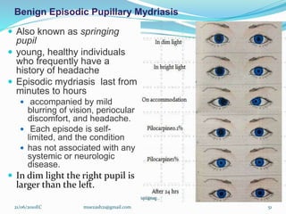 Benign Episodic Pupillary Mydriasis
 Also known as springing
pupil
 young, healthy individuals
who frequently have a
history of headache
 Episodic mydriasis last from
minutes to hours
 accompanied by mild
blurring of vision, periocular
discomfort, and headache.
 Each episode is self-
limited, and the condition
 has not associated with any
systemic or neurologic
disease.
 In dim light the right pupil is
larger than the left.
21/06/2010EC muezash21@gmail.com 51
 