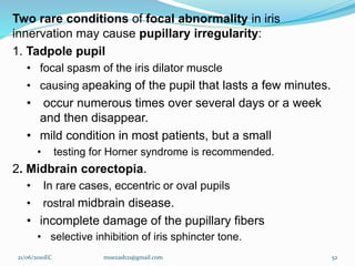 Two rare conditions of focal abnormality in iris
innervation may cause pupillary irregularity:
1. Tadpole pupil
• focal spasm of the iris dilator muscle
• causing apeaking of the pupil that lasts a few minutes.
• occur numerous times over several days or a week
and then disappear.
• mild condition in most patients, but a small
• testing for Horner syndrome is recommended.
2. Midbrain corectopia.
• In rare cases, eccentric or oval pupils
• rostral midbrain disease.
• incomplete damage of the pupillary fibers
• selective inhibition of iris sphincter tone.
21/06/2010EC muezash21@gmail.com 52
 