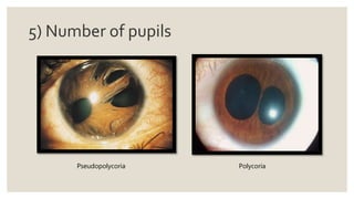 5) Number of pupils
Pseudopolycoria Polycoria
 