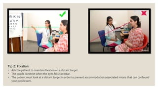 Tip 2: Fixation
• Ask the patient to maintain fixation on a distant target.
• The pupils constrict when the eyes focus at near.
• The patient must look at a distant target in order to prevent accommodation associated miosis that can confound
your pupil exam.
 