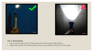 Tip 4: Illumination
• Use an evenly bright source of illumination for examining the light reflexes.
• Lights with uneven illumination patterns may cause variable constriction of the pupils.
 