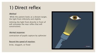 1) Direct reflex
Method:
While the patient looks at a distant target,
the light from inferiorly and slightly
(shining the light from directly in front of
will stimulate the near reflex that will
constriction).
Normal response:
contraction of pupils capture by sphincter
Record the speed of reaction:
brisk, sluggish, or fixed
 