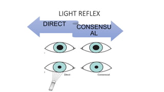 Light Reflex Present PUPILLARY ABNORMALITIES and pupillary reflexes | PPTX