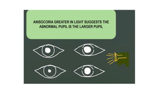 Pupil Mutations Types of pupillary abnormalities in Ophthalmology.pptx