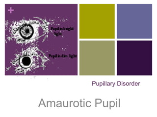 +




             Pupillary Disorder


    Amaurotic Pupil
 
