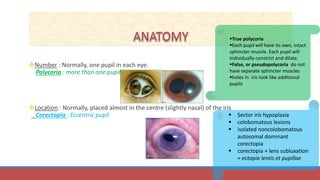 Polykorie PUPILLARY DISORDERS | PPTX