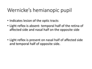 Wernicke’s hemianopic pupil
• Indicates lesion of the optic tracts
• Light reflex is absent- temporal half of the retina of
affected side and nasal half on the opposite side
• Light reflex is present on nasal half of affected side
and temporal half of opposite side.
 