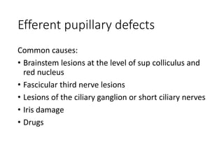 Efferent pupillary defects
Common causes:
• Brainstem lesions at the level of sup colliculus and
red nucleus
• Fascicular third nerve lesions
• Lesions of the ciliary ganglion or short ciliary nerves
• Iris damage
• Drugs
 