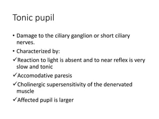 Tonic pupil
• Damage to the ciliary ganglion or short ciliary
nerves.
• Characterized by:
Reaction to light is absent and to near reflex is very
slow and tonic
Accomodative paresis
Cholinergic supersensitivity of the denervated
muscle
Affected pupil is larger
 