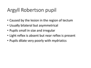 Argyll Robertson pupil
• Caused by the lesion in the region of tectum
• Usually bilateral but asymmetrical
• Pupils small in size and irregular
• Light reflex is absent but near reflex is present
• Pupils dilate very poorly with mydriatics
 