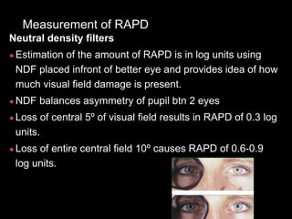 Pupillary pathway and its abnormality. | PPTX