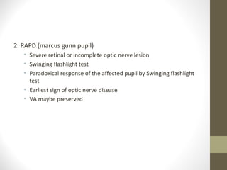 Pupillary reflexes | PPT