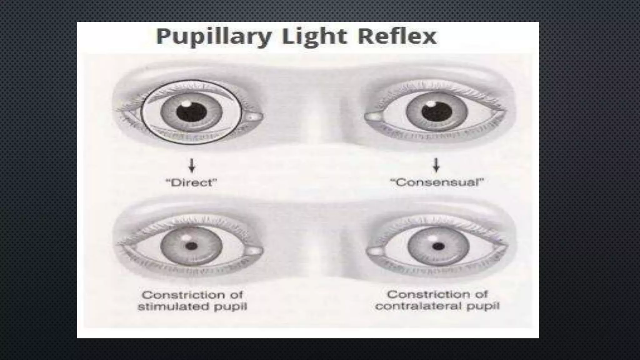 pupillary reflex ophthal.pptx
