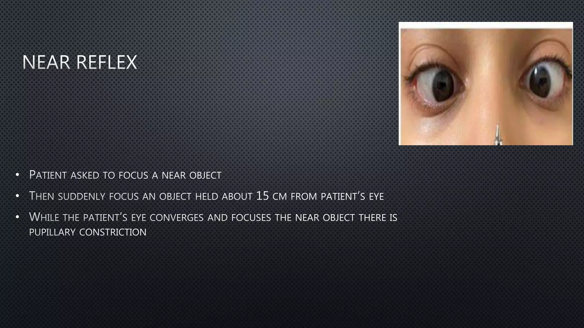 pupillary reflex ophthal.pptx