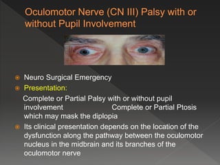  Neuro Surgical Emergency
 Presentation:
Complete or Partial Palsy with or without pupil
involvement Complete or Partial Ptosis
which may mask the diplopia
 Its clinical presentation depends on the location of the
dysfunction along the pathway between the oculomotor
nucleus in the midbrain and its branches of the
oculomotor nerve
 
