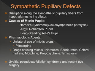  Disruption along the sympathetic pupillary fibers from
hypothalamus to iris dilator.
 Causes of Miotic Pupils:
Horner's Syndrome(Oculosympathetic paralysis)
Argyll Robertson Pupils
Long-Standing Adie's Pupil
 Pharmacologic Agents:
› Unilateral use of miotic drops:
 Pilocarpine
› Drugs causing miosis : Narcotics, Barbiturates, Chloral
hydrate, Morphine, Propoxyphene,Tamsulosin
 Uveitis, pseudoexofoliation syndrome and recent eye
surgery
 