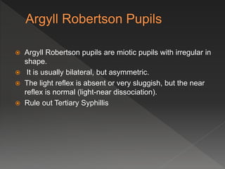  Argyll Robertson pupils are miotic pupils with irregular in
shape.
 It is usually bilateral, but asymmetric.
 The light reflex is absent or very sluggish, but the near
reflex is normal (light-near dissociation).
 Rule out Tertiary Syphillis
 