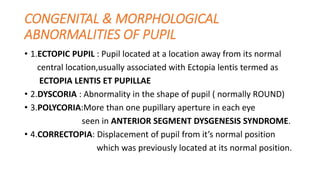 pupil ppt dr kavitha.pptx