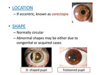 PUPIL Seminar final (3).pptx