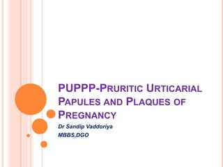 PUPPP-PRURITIC URTICARIAL
PAPULES AND PLAQUES OF
PREGNANCY
Dr Sandip Vaddoriya
MBBS,DGO
 