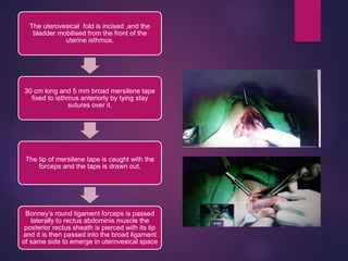 The uterovesical fold is incised ,and the
bladder mobilised from the front of the
uterine isthmus.
30 cm long and 5 mm broad mersilene tape
fixed to isthmus anteriorly by tying stay
sutures over it.
The tip of mersilene tape is caught with the
forceps and the tape is drawn out.
Bonney’s round ligament forceps is passed
laterally to rectus abdominis muscle the
posterior rectus sheath is pierced with its tip
and it is then passed into the broad ligament
of same side to emerge in uterovesical space
 