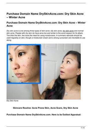 Purchase Domain Name DrySkinAcne.com: Dry Skin Acne
– Winter Acne
Purchase Domain Name DrySkinAcne.com: Dry Skin Acne – Winter
Acne
Dry skin acne is one among three types of skin acne: oily skin acne, dry skin acne and normal
skin acne. People with dry skin do have acne too and winter is the worst season for its attack.
The drier the skin, the more the need for using moisturizers. In summers retinoids should be
used regularly on skin, though a moisturizer cream and a strong sunscreen are inevitable to use
along.




Dry Skin Acne


       Skincare Routine: Acne Prone Skin, Acne Scars, Dry Skin Acne


Purchase Domain Name DrySkinAcne.com. Here is its Estibot Appraisal:




                                                                                         1/4
 