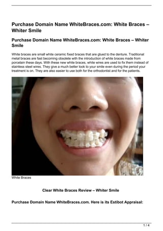 Purchase Domain Name WhiteBraces.com: White Braces –
Whiter Smile
Purchase Domain Name WhiteBraces.com: White Braces – Whiter
Smile
White braces are small white ceramic fixed braces that are glued to the denture. Traditional
metal braces are fast becoming obsolete with the introduction of white braces made from
porcelain these days. With these new white braces, white wires are used to fix them instead of
stainless steel wires. They give a much better look to your smile even during the period your
treatment is on. They are also easier to use both for the orthodontist and for the patients.




White Braces


                     Clear White Braces Review – Whiter Smile


Purchase Domain Name WhiteBraces.com. Here is its Estibot Appraisal:




                                                                                          1/4
 