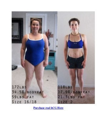 Purchase real hCG Here
 