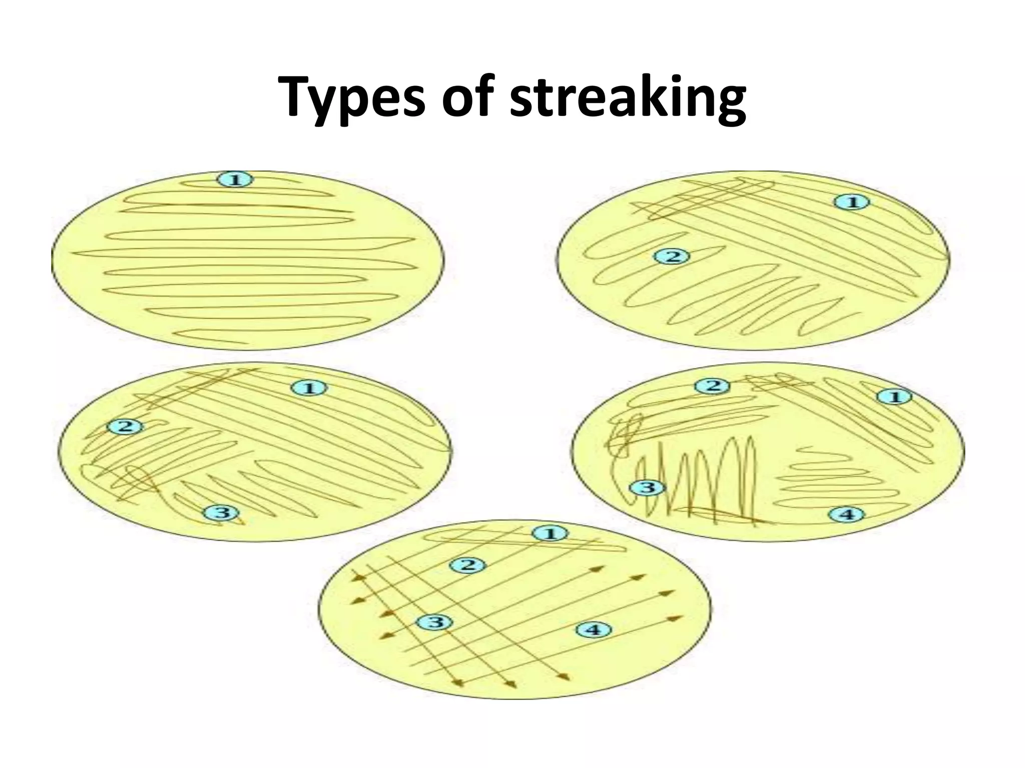 Types of streaking
