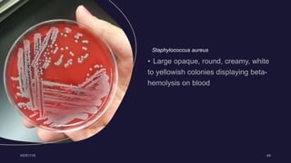 Staphylococcus aureus
 