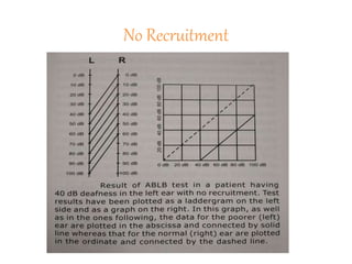 No Recruitment
 